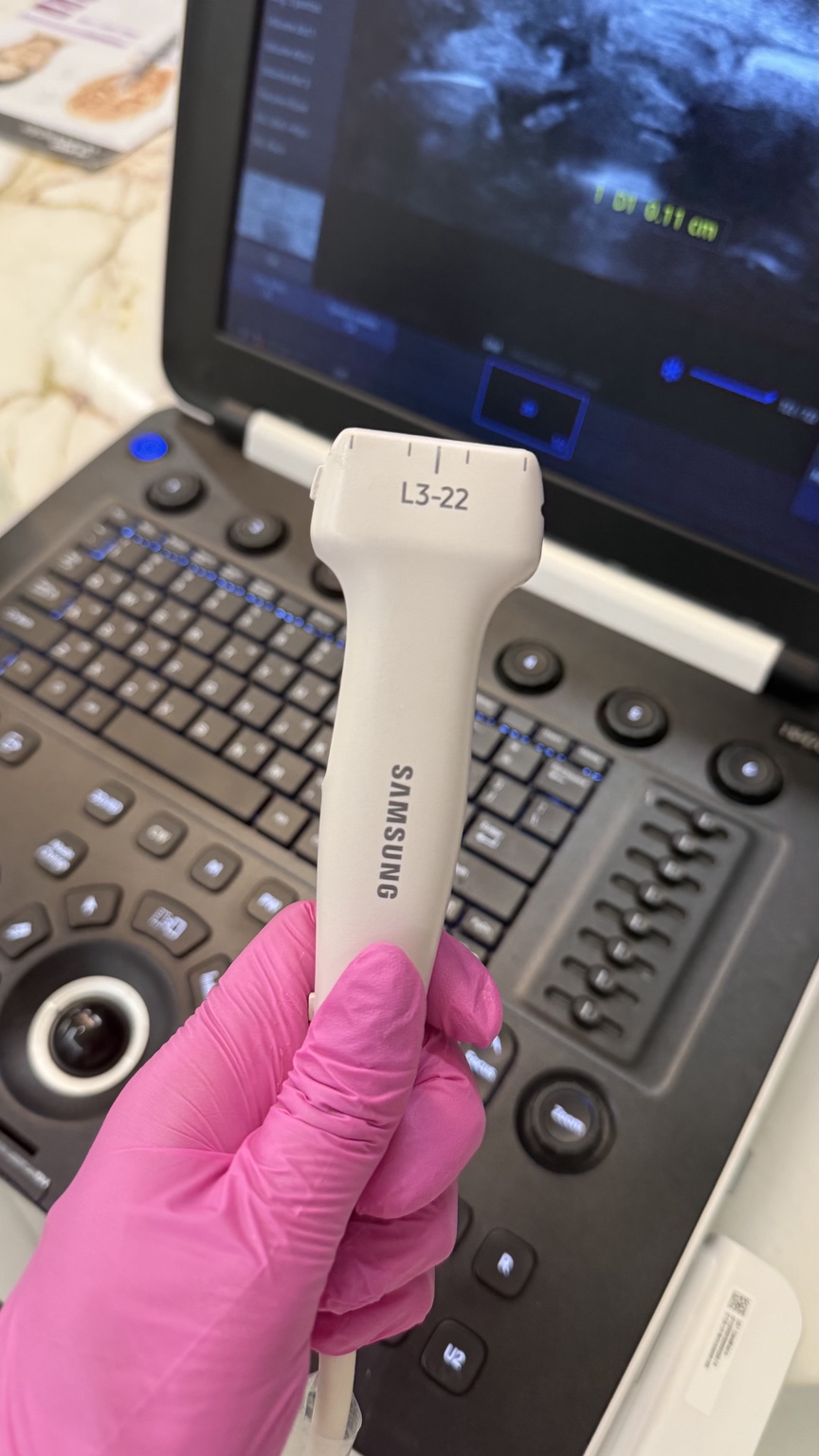 Equipamento de ultrassom e transdutor linear
